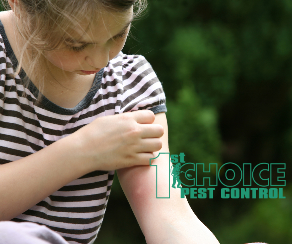 Protect Your Child From Annoying Mosquitoes Bites